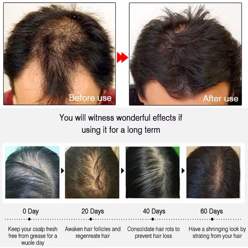 Semprotan Penumbuh Rambut Jahe - Hair Care Serum ulasan dan harga